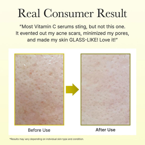 Arencia Vitamin C Booster Shot(Buy 1 Get 1 Free)